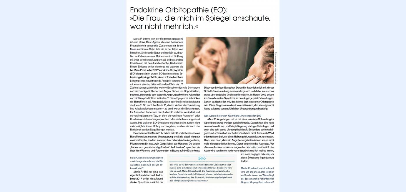 Endokrine Orbitopathie | Interview im STERN